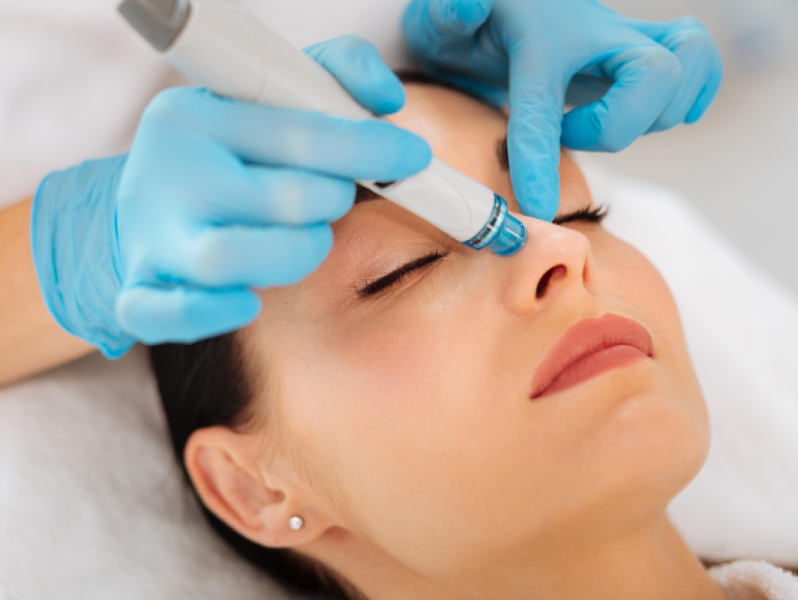 hydrafacial Vancouver