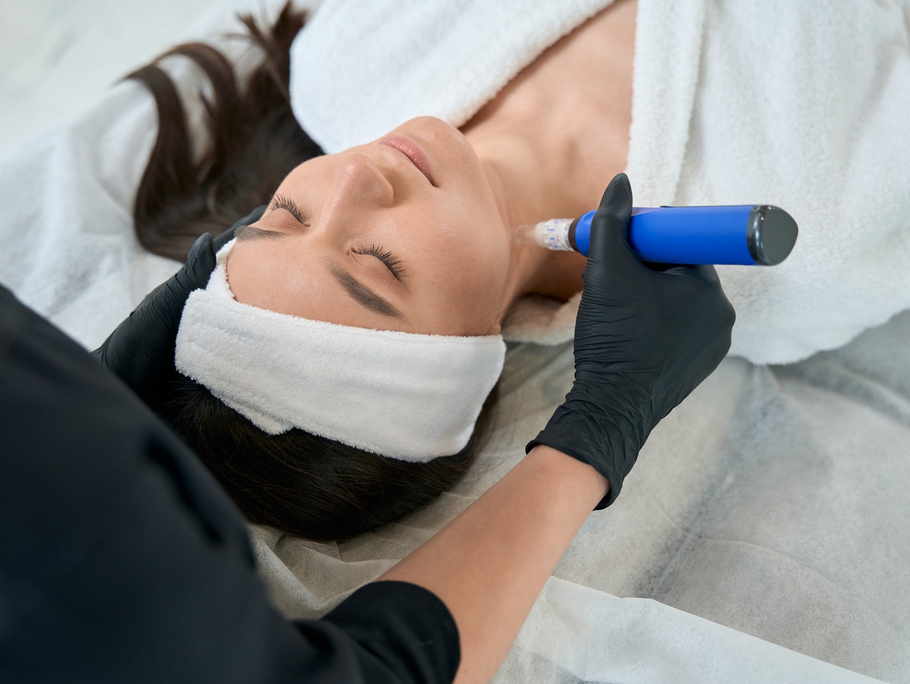 Skinpen Microneedling