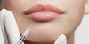 botox North Vancouver & lip filler Vancouver